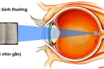 Năng suất phân ly của mắt, độ phân giải hiển thị